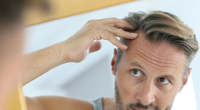 Pożegnaj się z łysymi plackami za pomocą włókien keratynowych! łysymi plackami